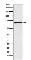 Western blot analysis of GABA Transporter 1 / GAT 1 expression in Human fetal brain lysate.