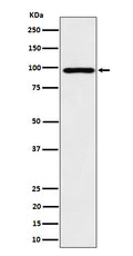 Western blot analysis of AKAP 95 expression in HepG2 cell lysate.