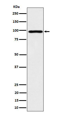 Western blot analysis of AKAP 95 expression in HepG2 cell lysate.
