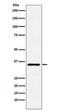 Anti-DCR2 Rabbit Monoclonal Antibody