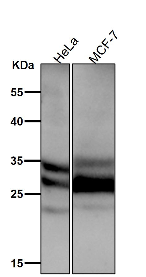 All lanes use the Antibody at 1:8K dilution for 1 hour at room temperature.