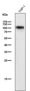 All lanes use the Antibody at 1:3K dilution for 1 hour at room temperature.