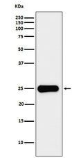 Western blot analysis of Placental lactogen expression in JAR cell lysate.