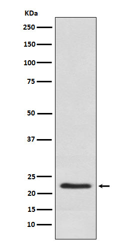 Western blot analysis of Placental lactogen expression in Human placenta lysate.