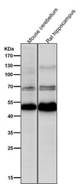 All lanes use the Antibody at 1:1K dilution for 1 hour at room temperature.
