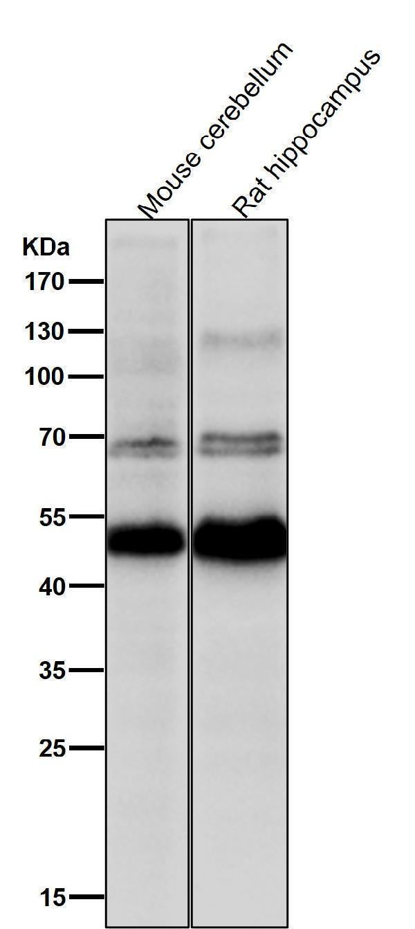All lanes use the Antibody at 1:1K dilution for 1 hour at room temperature.