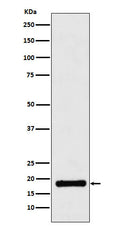 Western blot analysis of UBE2B expression in Jurkat cell lysate.