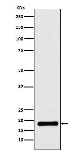 Western blot analysis of UBE2B expression in Jurkat cell lysate.