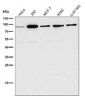 All lanes use the Antibody at 1:1K dilution for 1 hour at room temperature.