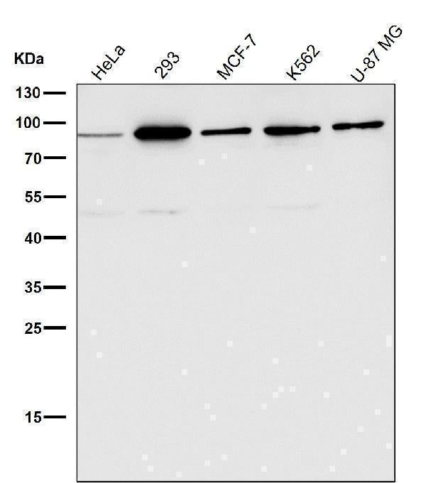 All lanes use the Antibody at 1:1K dilution for 1 hour at room temperature.