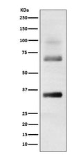 Western blot analysis of Loricrin expression in Human skin cell lysate.