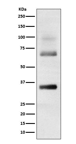 Western blot analysis of Loricrin expression in Human skin cell lysate.