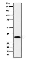 Western blot analysis of PPP6C expression in HeLa cell lysate.