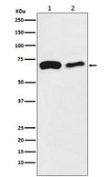 Western blot analysis of SLC27A4 / FATP4 expression in  (1) HeLa cell lysate; (2) Mouse kidney lysate.