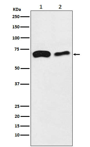 Western blot analysis of SLC27A4 / FATP4 expression in  (1) HeLa cell lysate; (2) Mouse kidney lysate.