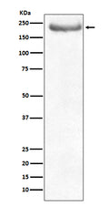 Western blot analysis of NEFH expression in human brain lysate.