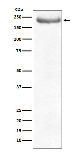 Western blot analysis of NEFH expression in human brain lysate.