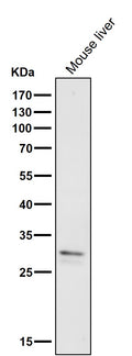All lanes use the Antibody at 1:1W dilution for 1 hour at room temperature.