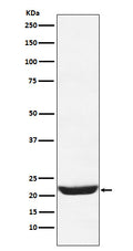 Western blot analysis of NCS1 expression in 293T cell lysate.