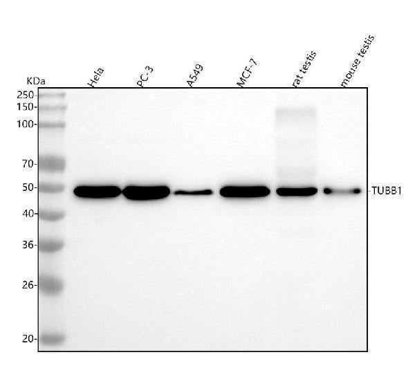 Anti-beta I Tubulin TUBB1 Rabbit Monoclonal Antibody