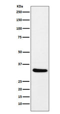 Western blot analysis of CRALBP expression in mouse eyeball lysate.