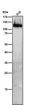 Anti-Integrin beta 7 Rabbit Monoclonal Antibody