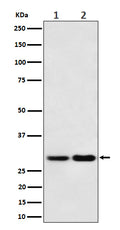 Western blot analysis of MTAP expression in (1) 293T cell lysate; (2) NIH/3T3 cell lysate.