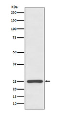 Anti-Kappa light chain IGKC Rabbit Monoclonal Antibody
