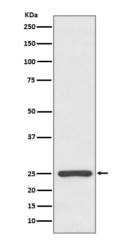 Anti-Kappa light chain IGKC Rabbit Monoclonal Antibody