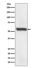 Western blot analysis of 58K Golgi protein expression in human fetal liver lysate.