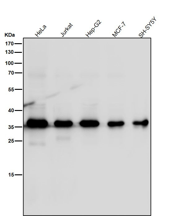 All lanes use the Antibody at 1:3K dilution for 1 hour at room temperature.