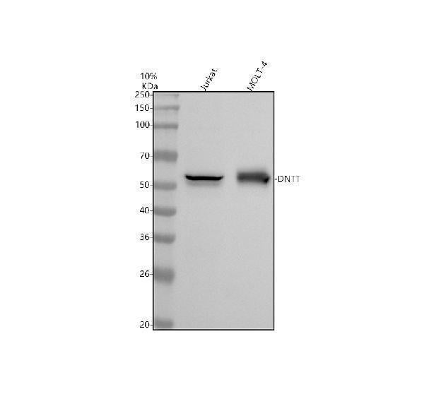 Anti-TDT DNTT Monoclonal Antibody