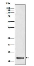 Western blot analysis of TCTEX1 expression in HeLa cell lysate.