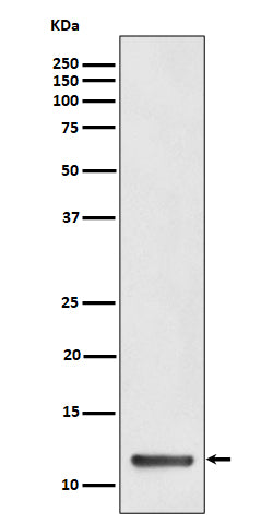 Western blot analysis of TCTEX1 expression in HeLa cell lysate.