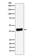 Western blot analysis of Galectin 8 expression in LNCaP cell lysate.