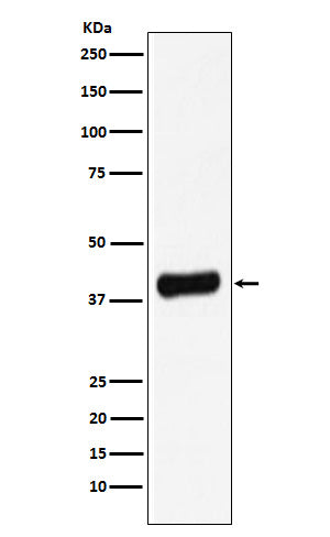 Western blot analysis of Galectin 8 expression in LNCaP cell lysate.