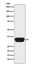 Western blot analysis of Otx1/2  expression in Y79 cell lysate.