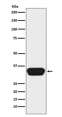 Western blot analysis of Otx1/2  expression in Y79 cell lysate.
