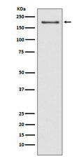 Western blot analysis of NSD3 expression in MCF-7 cell lysate.