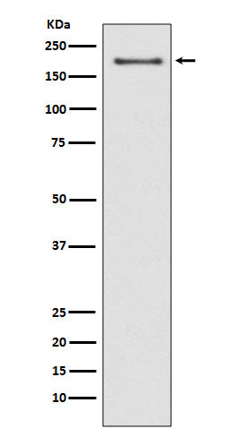 Western blot analysis of NSD3 expression in MCF-7 cell lysate.