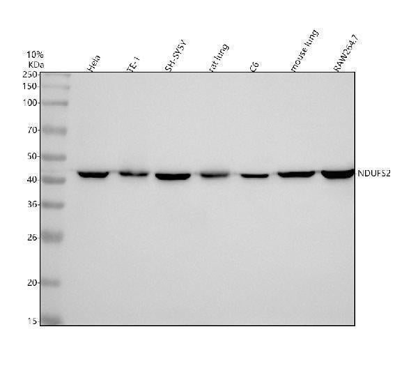 Anti-NDUFS2 Rabbit Monoclonal Antibody