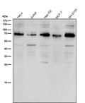 All lanes use the Antibody at 1:1K dilution for 1 hour at room temperature.