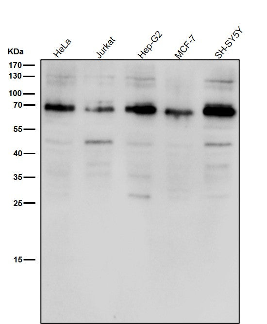 All lanes use the Antibody at 1:1K dilution for 1 hour at room temperature.
