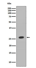 Western blot analysis of HOXB9 expression in MCF7 cell lysate.