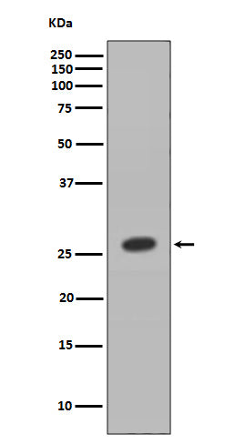 Western blot analysis of HOXB9 expression in MCF7 cell lysate.