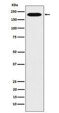 Western blot analysis of RhoGAP expression in Hela cell lysate.