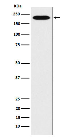 Western blot analysis of RhoGAP expression in Hela cell lysate.