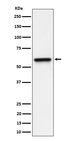 Western blot analysis of RGS6 expression in HeLa cell lysate.
