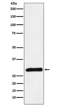 Western blot analysis of PRSS2 expression in Human pancreas lysate.