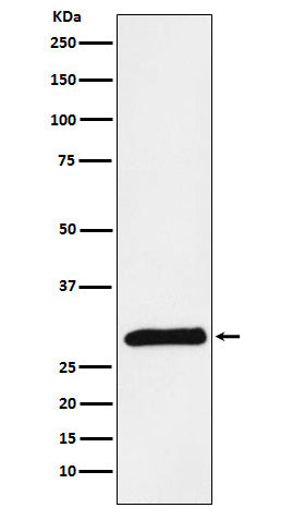 Western blot analysis of PRSS2 expression in Human pancreas lysate.